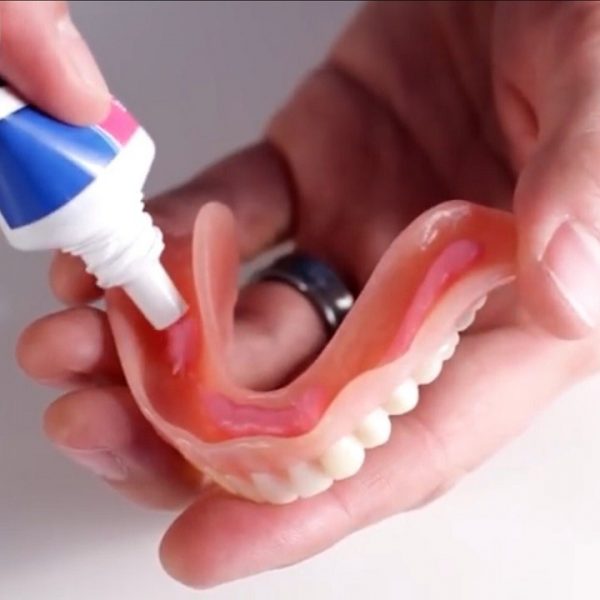 Keo dán nha khoa tháo lắp