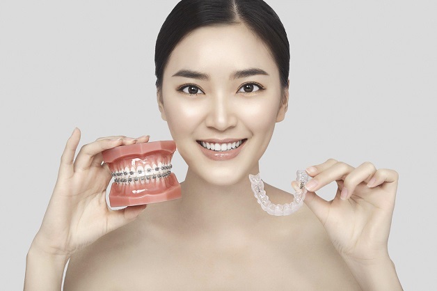 Niềng răng đẹp cỡ nào?