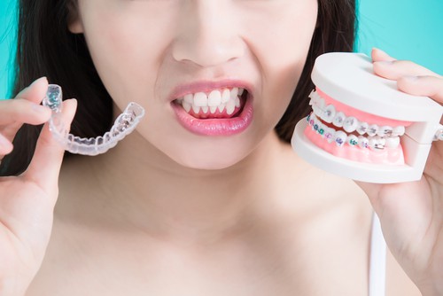 Niềng răng giá rẻ có thể gây ra nhiều hệ lụy cho sức khỏe răng miệng