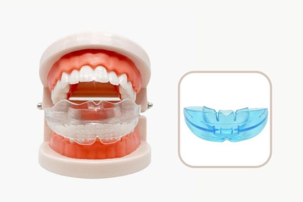Các chuyên gia phân chia máng niềng thành các loại dựa trên độ tuổi