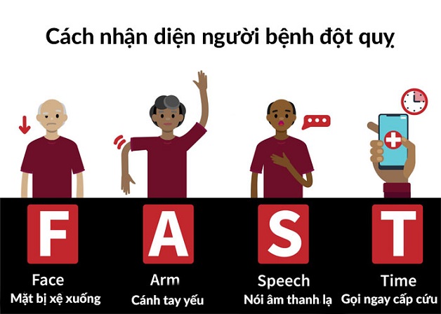 Nhận biết bệnh nhân tai biến