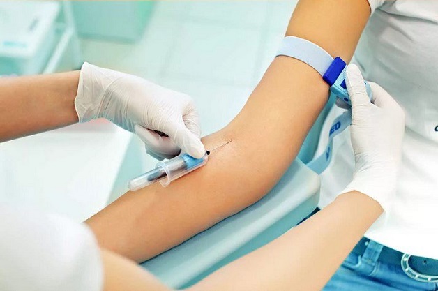 Xét nghiệm gan tại gia đình có thể làm những gì?