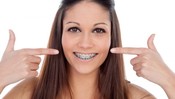 Niềng răng giúp cải thiện hiệu quả tình trạng móm, mang lại nụ cười rạng ngời tự tin