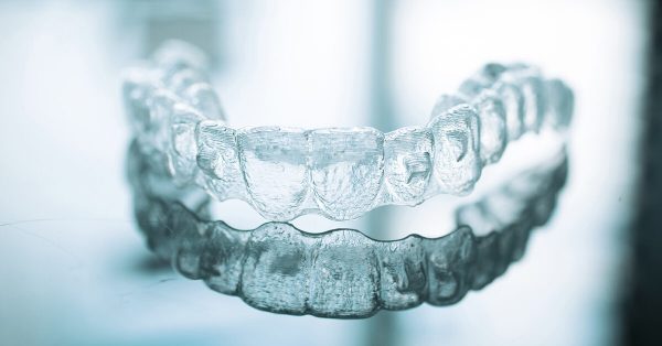 Giá niềng răng không mắc cài dao động từ 80-150 triệu đồng, tùy thuộc vào rất nhiều yếu tố