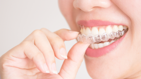 Niềng răng trong suốt giúp mọi người tự tin hơn trong quá trình niềng