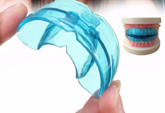 Niềng răng Silicon là phương pháp chủ yếu sử dụng ở trẻ em, tuy nhiên cũng có thể áp dụng với trường hợp người trưởng thành ở giai đoạn đầu tiên của chỉnh nha