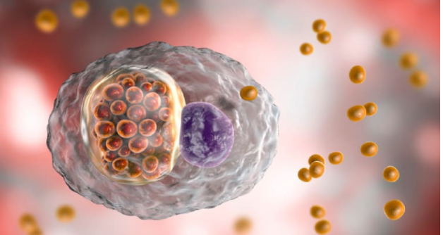 Bệnh đau mắt hột là một bệnh lý sinh ra do viêm kết mạc và giác mạc bởi vi khuẩn Chlamydia Trachomatis gây ra