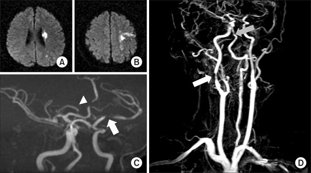 hình ảnh chụp MRI