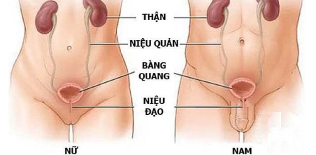 bệnh sỏi niệu đạo