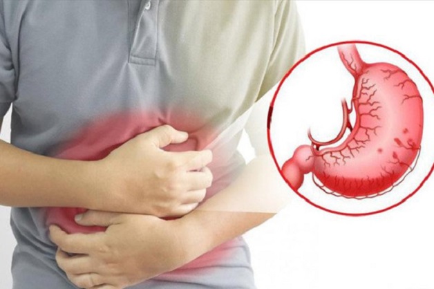 Biến chứng viêm loét dạ dày tá tràng