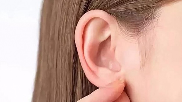 Vành tai là phần thịt nhô ra 2 bên đầu, rất dễ dàng để nhìn thấy.