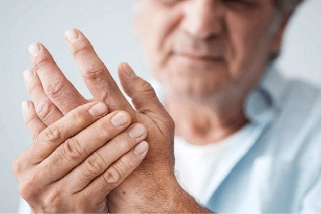 Triệu chứng sưng, đỏ, nóng khi bị viêm khớp dạng thấp