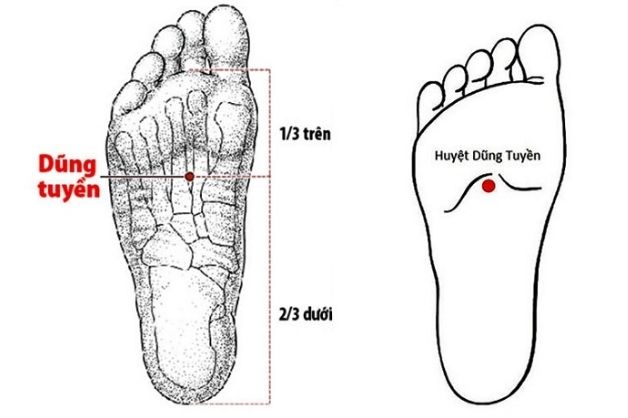 Bấm huyệt dũng tuyền chữa mất ngủ