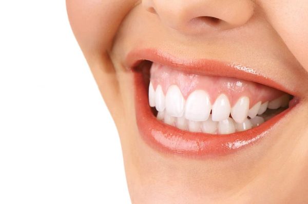 Cười hở lợi là tình trạng lộ nướu hàm trên quá mức khi cười khiến nụ cười kém duyên và làm cho mọi người cảm thấy thiếu tự tin trong giao tiếp