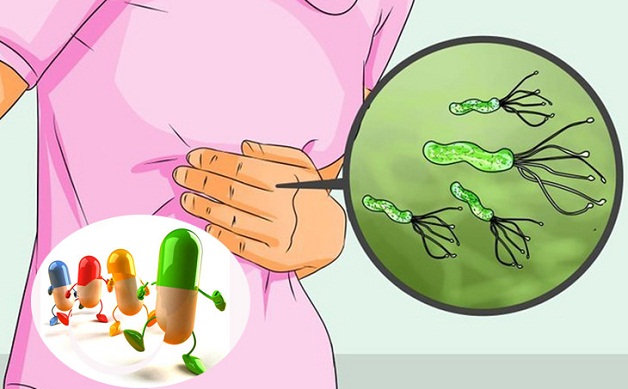 Phác đồ điều trị bệnh viêm loét dạ dày HP