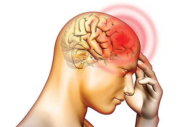 chụp CT sọ não giúp phát hiện nhiều bệnh lý