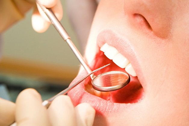 Thời gian hàn răng sâu có lâu không còn phụ thuộc vào nhiều yếu tố