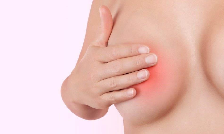 Khi bị tắc tia sữa ngực mẹ trở lên căng cứng, nóng đỏ, đau nhức, khi sờ vào cảm nhận được một hoặc nhiều điểm cứng,...