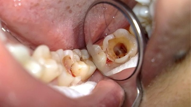 Tốt hơn hết bạn nên thăm khám bác sĩ để có thể trả lời chính xác cho câu hỏi