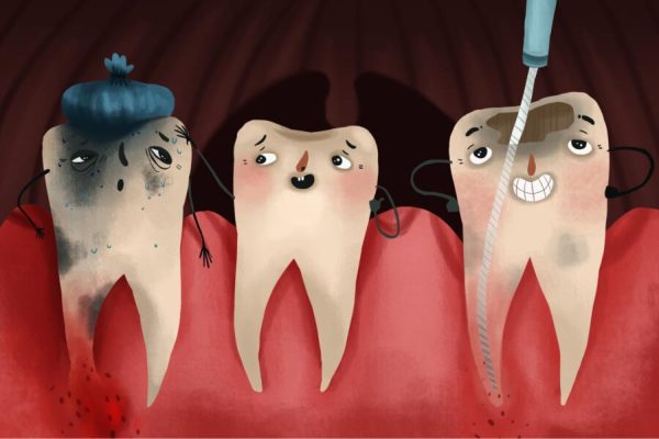Khi bị viêm chân răng, người bệnh thường gặp phải các tình trạng sưng nướu, đau chân răng...