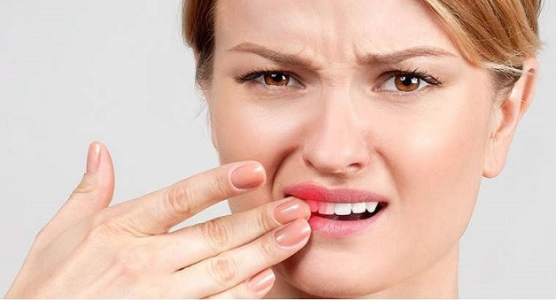 Khi bị viêm lợi thì nướu của chúng ta sẽ bị đỏ và sưng