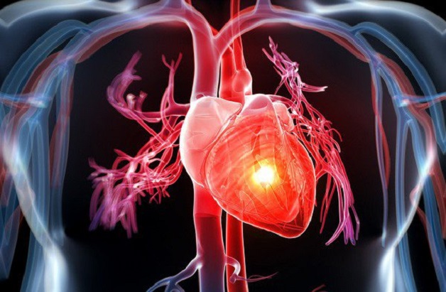 chụp MRI phát hiện bệnh tim