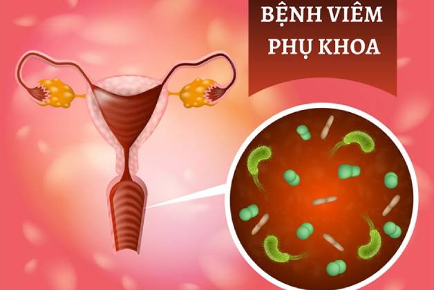bệnh phụ khoa