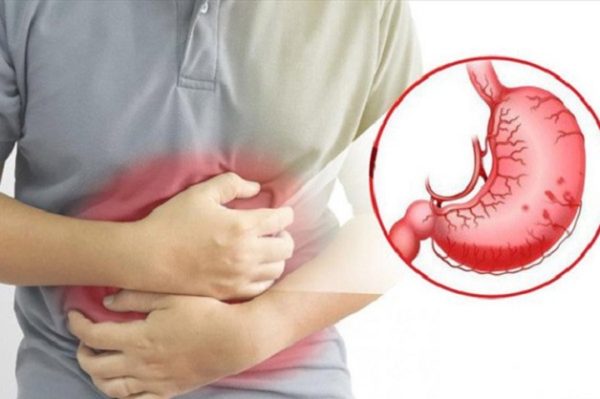 Biến chứng viêm loét dạ dày