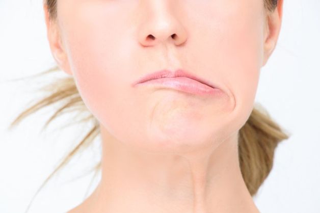 Dấu hiệu cơ mặt tê cứng, nói lắp, cười méo miệng ở người tai biến