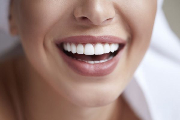 Thẩm mỹ vượt trội, ăn nhai bình thường... là các ưu điểm của bọc răng sứ thẩm mỹ