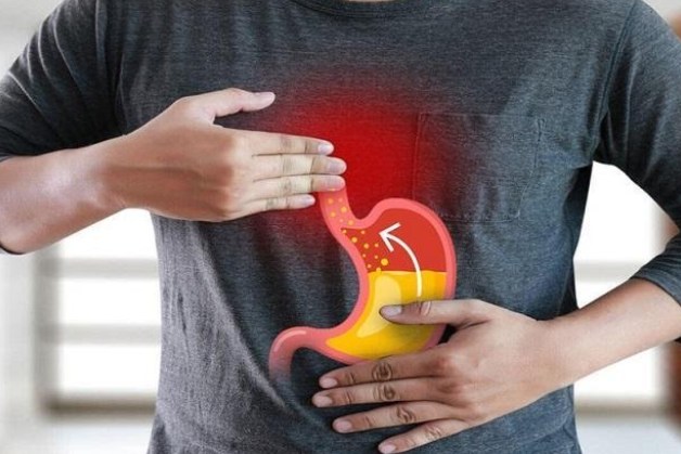 Trào ngược dạ dày thực quản