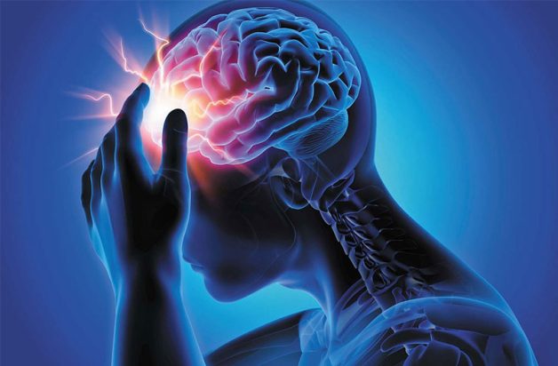 Nhồi máu não là một biến chứng tim mạch nguy hiểm và có tỷ lệ tử vong cao
