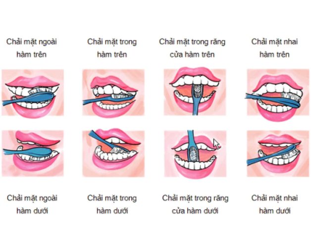 cách chống sâu răng hiệu quả