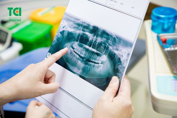 Cấy ghép Implant có an toàn không phụ thuộc vào việc thực hiện tại các cơ sở nha khoa