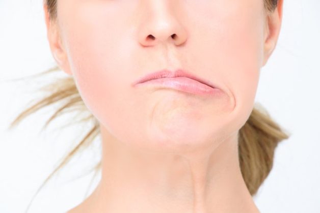Mặt không cân xứng là một trong những dấu hiệu đột quỵ sớm thường thấy