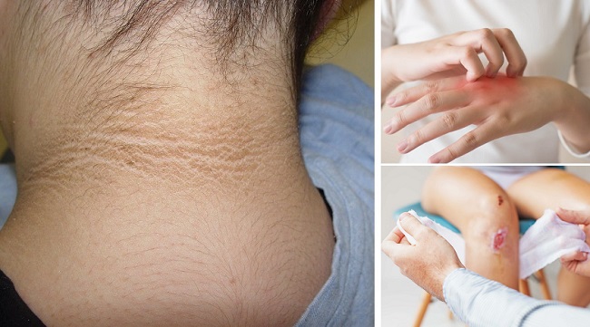 Dấu hiệu tiểu đường type2