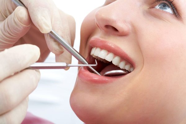 Hàn răng mất bao lâu phụ thuộc vào rất nhiều yếu tố như tình trạng răng, số răng cần hàn, tay nghề của bác sĩ...