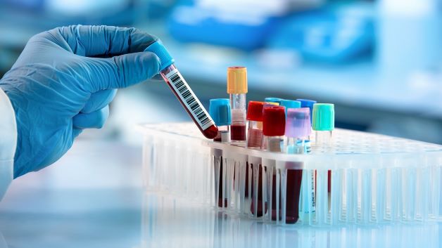 Xét nghiệm công thức máu giúp chị em hiểu rõ hơn về tình trạng sức khỏe của bản thân