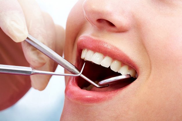 Cải thiện sức khỏe răng miệng là một trong những lợi ích của lấy cao răng