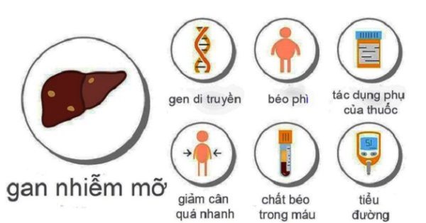 Gan nhiễm mỡ nên uống gì trong quá trình điều trị