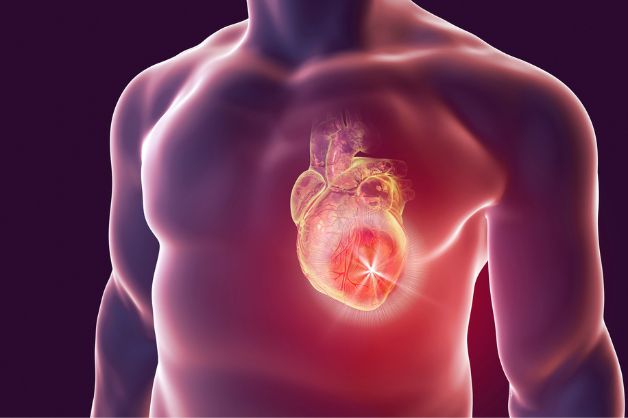Nguyên nhân gây ra cơn tai biến mạch máu não