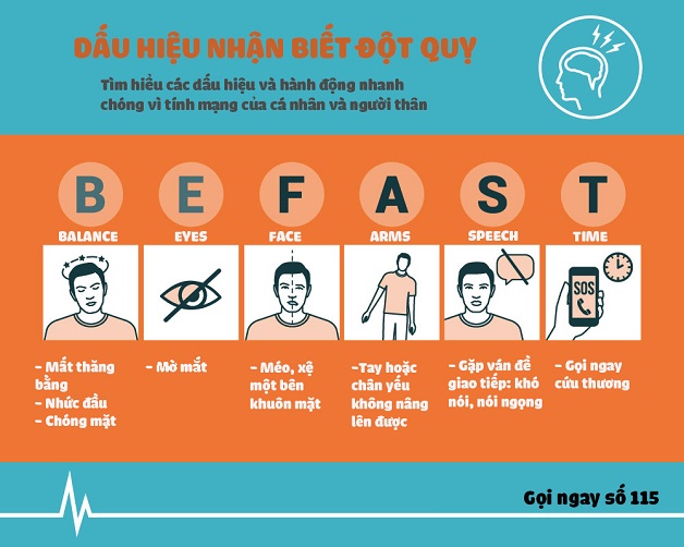 Triệu chứng của bệnh đột quỵ biểu hiện như thế nào?