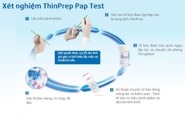 xét nghiệm thinprep