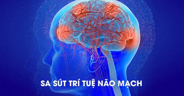 sa sút trí tuệ