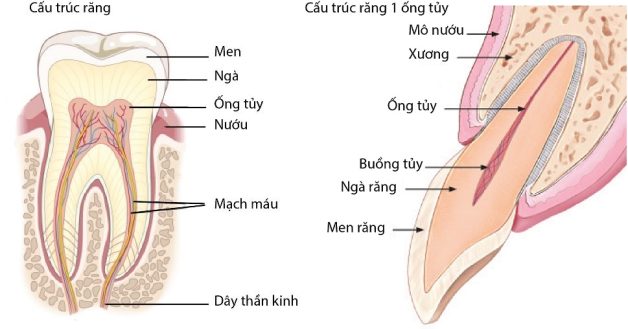 sâu răng ăn vào tủy