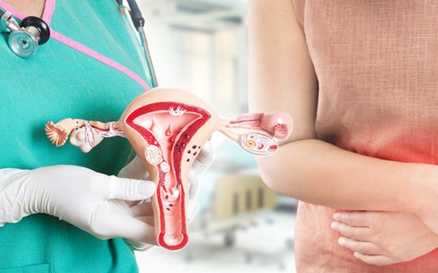 vai trò của sàng lọc ung thư buồng trứng