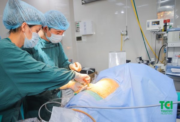 tán sỏi nội soi qua da bằng đường hầm nhỏ