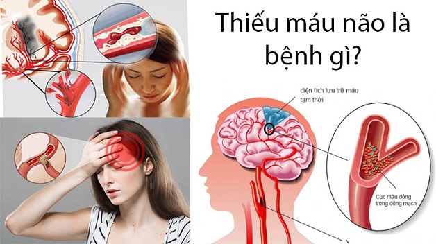 thiếu máu não gây triệu chứng mất ngủ về đêm
