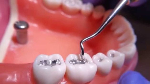 viêm quanh cuống cấp