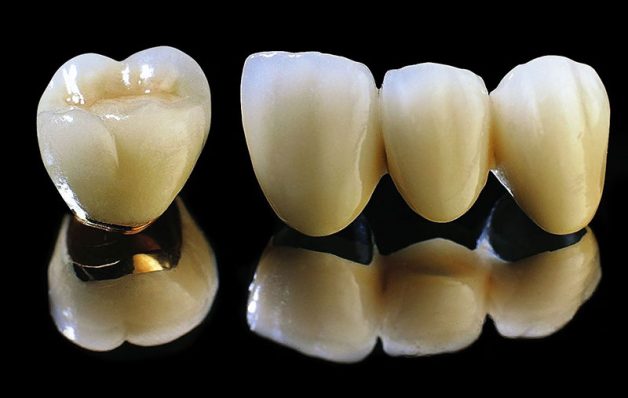 Có bao nhiêu loại răng sứ đảm bảo công năng xử lý thức ăn? Cả 4 loại đều đảm bảo